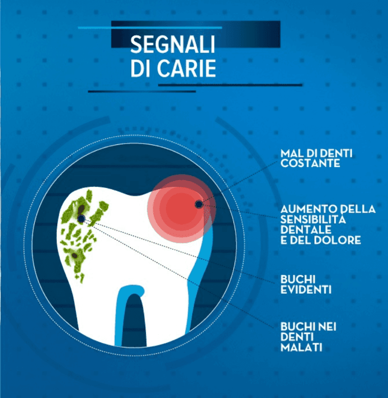 carie denti